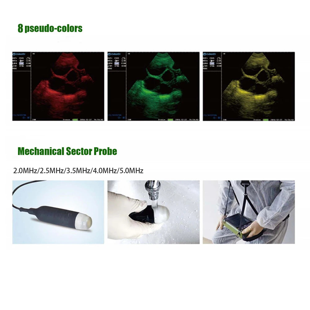 Dawei Veterinary Ultrasound Scanner With 3.5MHz Convex Probe