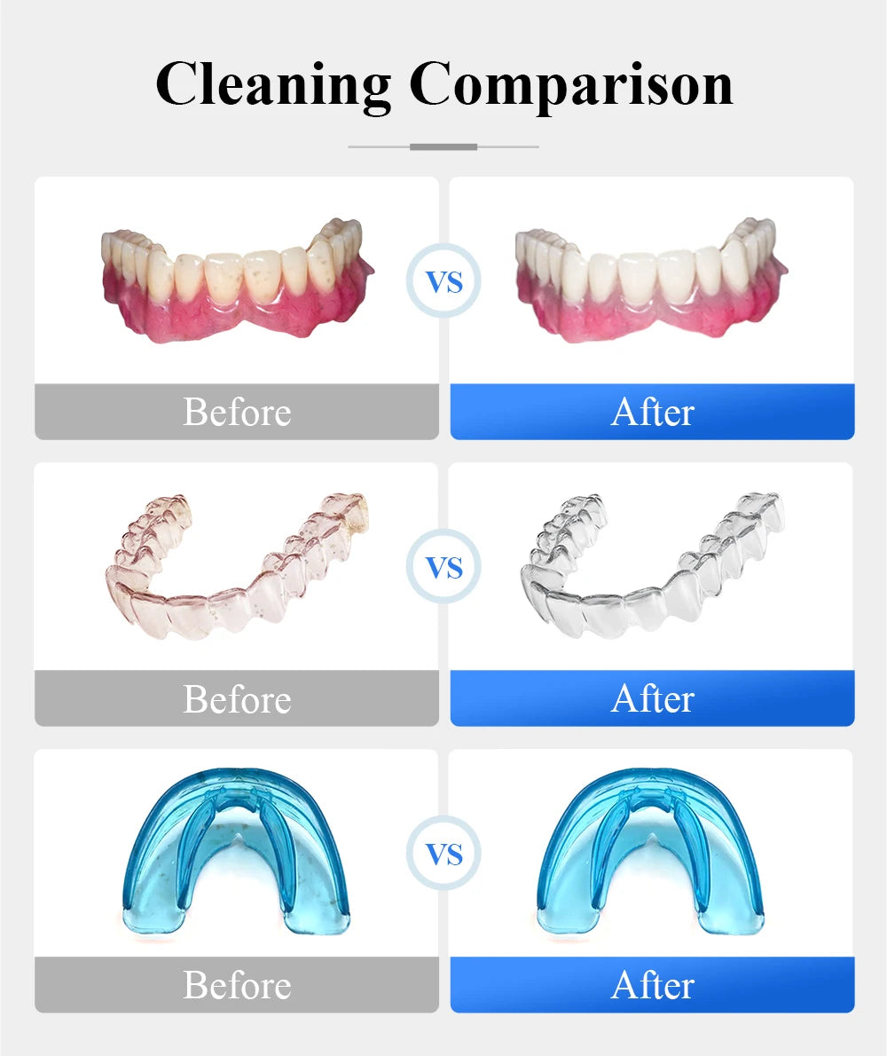 Tullker Ultrasonic Retainer Cleaner with UV Light for Jewelry